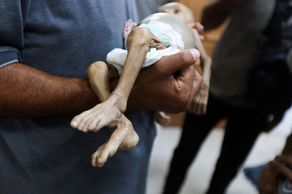 Gaza’s Children Are Dying of Hunger – And It’s Entirely Preventable